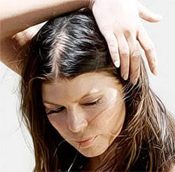 Lee más sobre el artículo 3 Factores que incrementan la alopecia en las mujeres