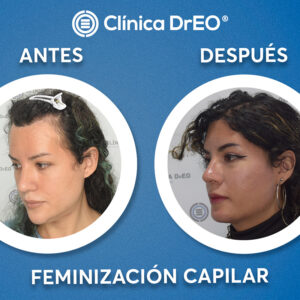 feminizacion